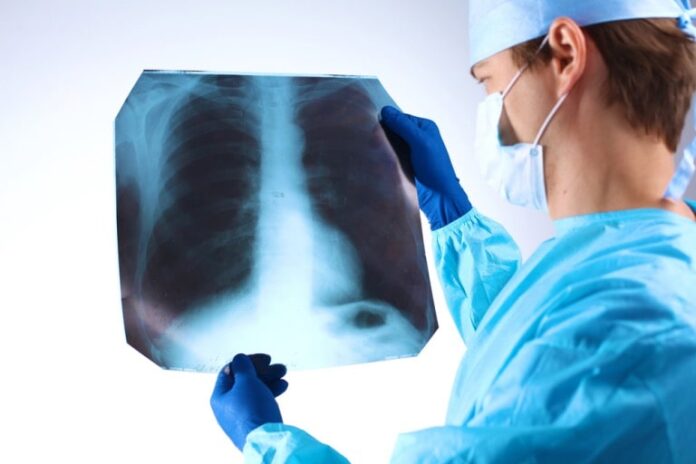 key factors new jersey lawyers consider in mesothelioma cases